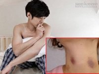Những vết bầm tím trên người vợ sau mỗi buổi đi dạy thêm và bí mật khiến chồng đau đớn