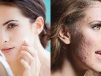 Những sai lầm nghiêm trọng cô nàng nào cũng mắc phải khiến da xấu tệ hại