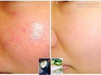 Lỗ chân lông se khít khìn khịt sau 1 tuần chỉ bằng sả – bia – dưa chuột, bạn đã thử chưa?