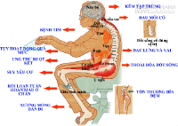 Cảnh báo những tác hại khôn lường của việc ngồi nhiều, ngồi quá lâu