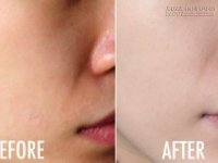 Không cần kem trộn, da vẫn trắng mịn sau 1 tuần với 2 nguyên liệu siêu rẻ tiền