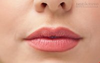 5 dấu hiệu trên môi bạn không bao giờ nên bỏ qua