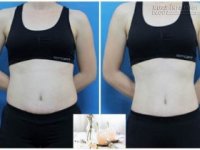 Cứ uống hỗn hợp này là mỡ thừa cứng đầu đến đâu cũng sẽ bị đốt cháy hết trong 2 tuần
