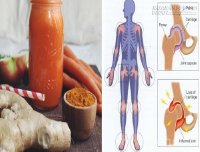 Thức uống chữa bệnh viêm khớp thần kỳ hơn cả thuốc đắt tiền