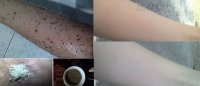 Công thức lấy lại làn da trắng mịn sau khi bị sạm đen đơn giản không ngờ