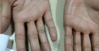 Tay chân khô ráo hết sạch mồ hôi chỉ bằng 1 nắm lá lốt