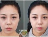 Trẻ ra 10 tuổi, da không 1 nếp nhăn chỉ cần sử dụng hỗn hợp này trong 1 tuần