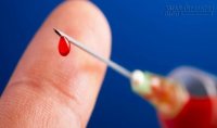 Cách sơ cứu và điều trị khi bị đâm kim tiêm nghi dính máu HIV