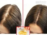 Thuốc chữa rụng tóc nhà nào cũng có sẵn mà bạn không biết