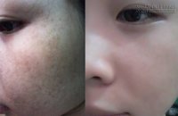 Với 3 phút mỗi ngày bạn có ngay làn da mịn màng vạn người mê