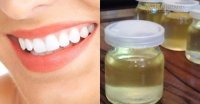 Nhà có thứ này thì không bao giờ phải đến nha sĩ lấy cao răng cho tốn tiền