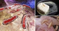 Hãy dừng ngay việc ăn những loại thực phẩm này nếu bạn không muốn chết sớm