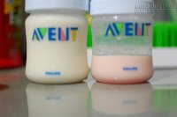 Khi đi tiểu có dấu hiệu sau, phải khám ngay kẻo mắc bệnh hiểm