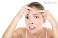 Mặt mọc mụn ở những vị trí này có nghĩa là bạn đang có bệnh