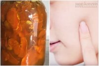 Có lọ nước thần này trong tay, chắc chắn da sẽ trắng mịn và không một vết thâm nám