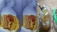 Đánh bay mỡ bụng, hết táo bón chỉ cần uống 2 muỗng này mỗi ngày