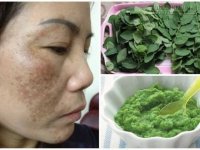 Cả tuần chỉ với mớ rau ngót 4 ngàn đồng, nám da trên mặt hết hoàn toàn