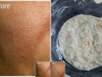 Làm theo đúng cách dưới đây, lỗ chân lông chắc chắc se khít khìn khịt trong tích tắc