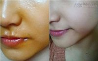Dù bắt nắng đen xì làm công thức này 5 ngày cũng trắng như trứng gà bóc