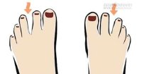 Xem tướng ngón chân đoán tính cách và vận số giàu nghèo