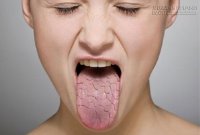 Uống ít nước hại như hút thuốc lá