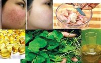 Cách trị sẹo rỗ trên mặt hiệu quả 100% chỉ sau 1 tuần