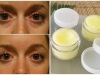 Mách bạn cách làm kem trị quầng thâm mắt hiệu quả chỉ sau 3 ngày