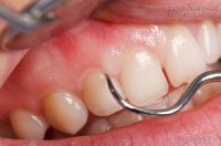 Hàm răng tiết lộ nhiều điều về sức khỏe của bạn