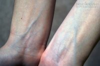 Nhìn thấy điều bất thường này, cơ thể bạn đang tố cáo các bệnh nguy hiểm nào?