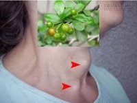 Bài thuốc hay chữa trị bướu cổ bằng cây Bùm xụm