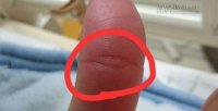Vân mắt Phật trên ngón tay báo hiệu cả đời tài lộc, an nhiên