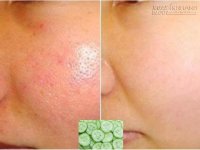 Lỗ chân lông se khít khìn khịt với 5 loại mặt nạ tự nhiên