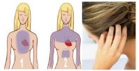 Sợi tóc có thể dự báo một cơn đau tim sắp xảy ra