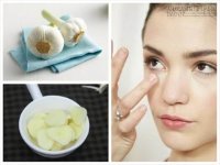 Mẹo hay giúp mụn xẹp nhanh và không sưng đỏ chỉ sau 8 tiếng