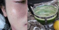 Da hết nám, sạch mụn, trắng mịn chỉ sau 1 tháng nhờ hỗn hợp đơn giản này