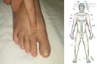 Massage điểm này 2 phút mỗi ngày và điều kì diệu sẽ xảy ra với cơ thể bạn