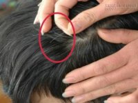 Tác hại ít biết từ việc nhổ tóc bạc