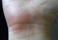 Những đặc điểm trên bàn tay chứng tỏ bạn thuộc diện ế bền vững