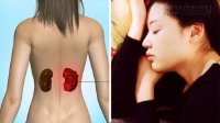 5 điều ai cũng phải biết để phòng tránh căn bệnh ung thư thận