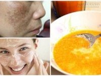 Công thức bí truyền giúp xóa sạch sành sanh nám da bằng 1 quả cam