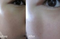 Sở hữu làn da căng mướt suốt hè với 2 phút mỗi ngày, bạn nên thử ngay