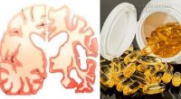 5 loại vitamin quan trọng cho não giúp phòng ngừa Alzheimer và mất trí nhớ