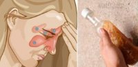 Viêm xoang lâu năm cũng hết ngay lập tức khi dùng hỗn hợp này