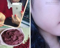Cách biến da sạm thành da trắng nhờ đậu đỏ, sữa tươi, trứng gà