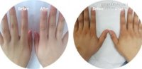 Dưỡng Da Tay Trắng Mịn Không Ăn Nắng, 1 Ngày/Lần Hiệu Quả Trong 2 Tuần