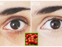 Trẻ hơn 10 tuổi nhờ dùng hỗn hợp rẻ tiền này đánh bay quầng thâm, bọng mắt