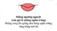 Dự đoán vận mệnh qua tướng miệng