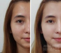Không cần dùng kem đắt tiền, chỉ cần bôi thứ này lên mặt, tối hôm trước da đen sạm, khô sần sáng hôm sau căng bóng, mịn màng như gái 18