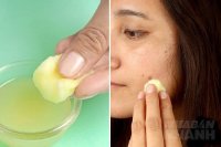 Muốn da trắng mịn không tỳ vết thoa ngay 1 giọt nước thần này mỗi khi đi ngủ