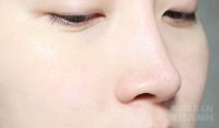 Đun gạo với sữa tươi theo cách này, làn da căng mịn như em bé, săn chắc và xóa mờ các vết thâm chỉ sau 15 phút